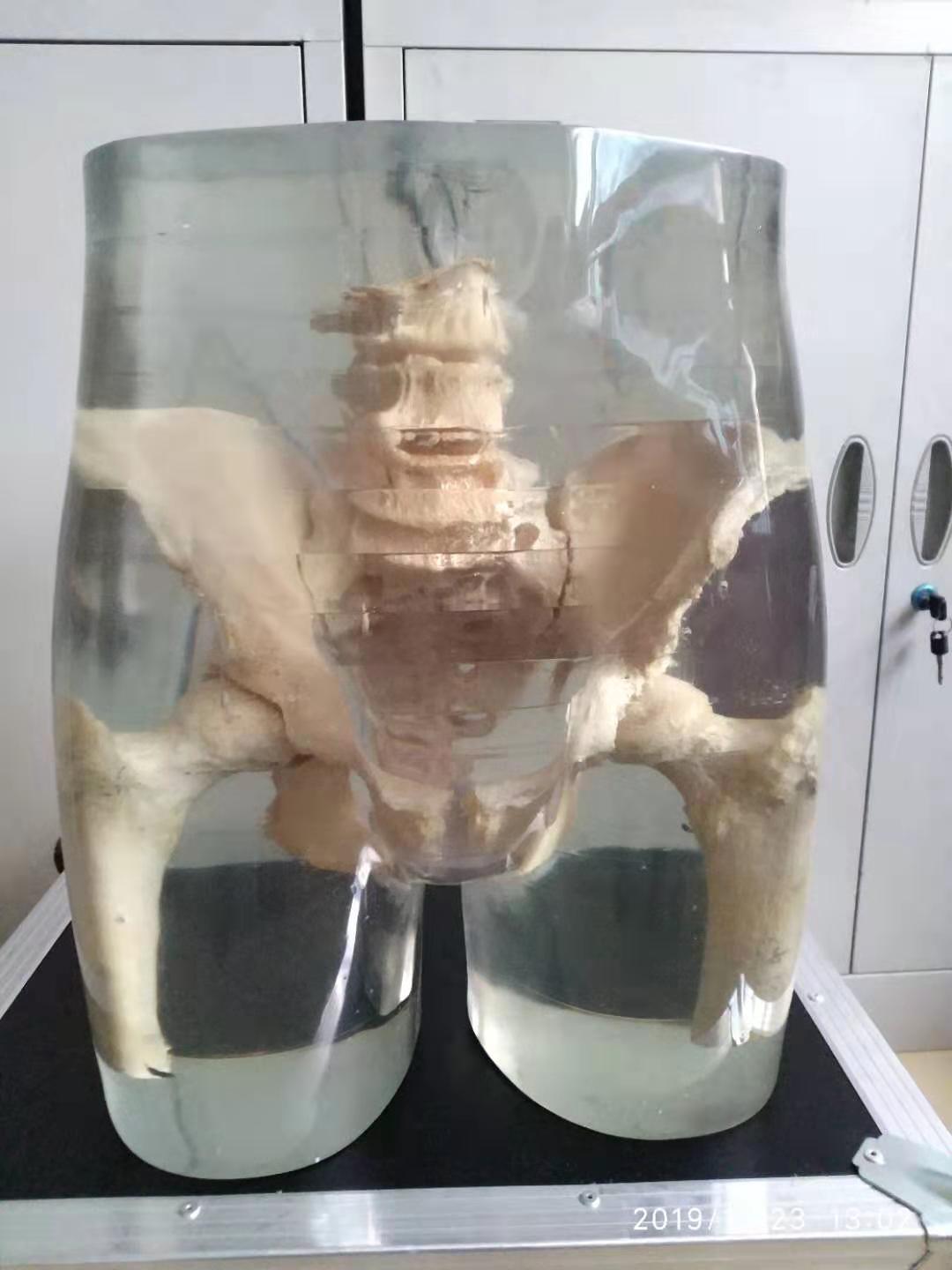 ˹^X侀ֲģwX侀_ģwX侀yPģw