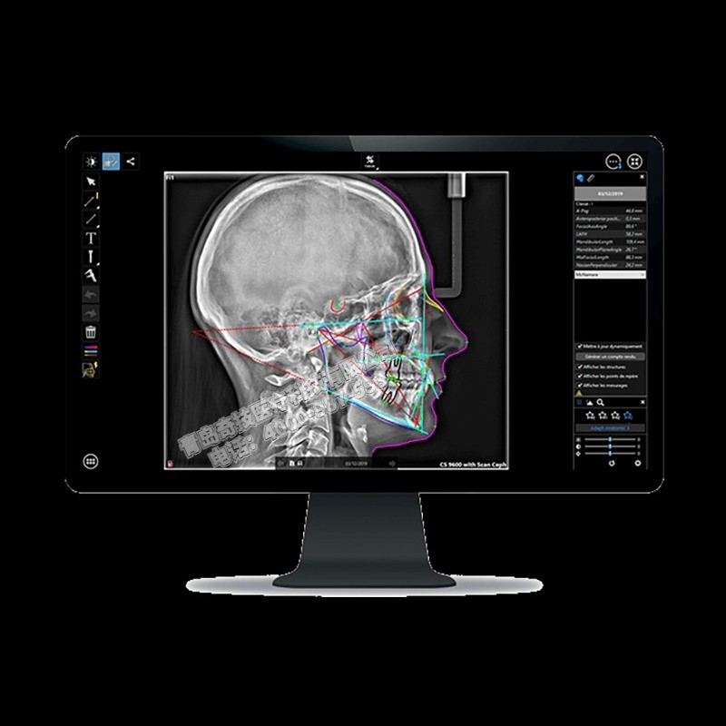 CǻȫC(j)CBCTJCarestreama(chn)ƷBS